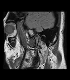 imagerie atm. aide diagn. troubles cranio-mandibu.